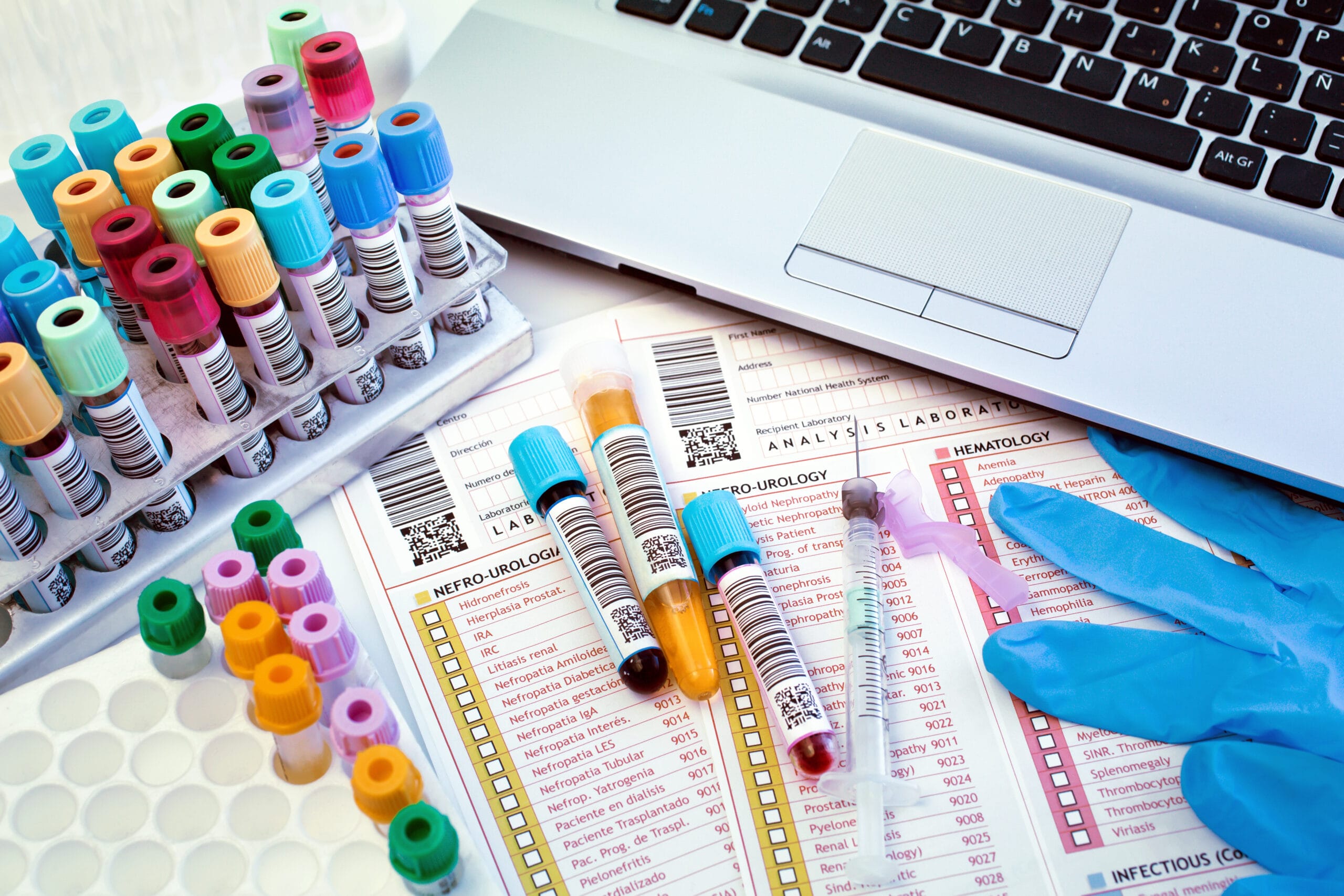 lab work bench with blood tubes and medical reports / laboratory work table with tools of a lab technician to perform a blood test